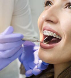 What are the Health Benefits of Orthodontics?