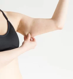 Achieve Sculpted Arms with Arm Liposuction by Dr. Nazmi Baycin